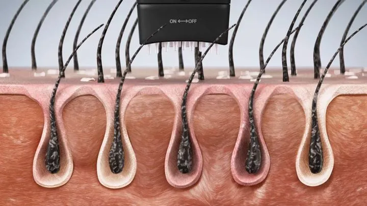 두피 케어 원리 — 상세페이지 3D 작업