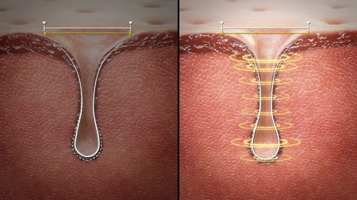 모공 케어 원리 — 상세페이지 3D 작업